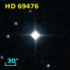 HD  69476
