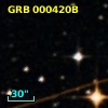 GRB 000420B