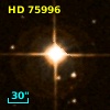 HD  75996