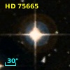 HD  75665
