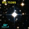 HD  75395