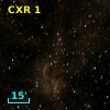 CXR  1