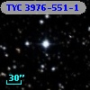 TYC 3976-551-1