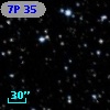 7P 35