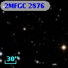 2MFGC 2876