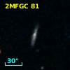 2MFGC 81