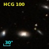HCG 100