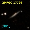 2MFGC 17796