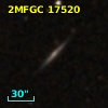 2MFGC 17520