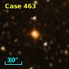 V* V2029 Cyg