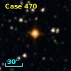 V* V1525 Cyg