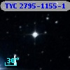 TYC 2795-1155-1