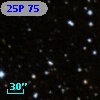 25P 75