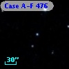 Case A-F  476