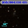 [KVD2004] ESO 435-G25 B