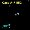 Case A-F  552