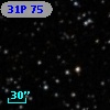 31P 75