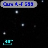 Case A-F  589