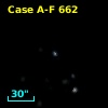 Case A-F  662