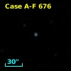 Case A-F  676