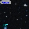 Anon 1151-30
