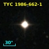 TYC 1986-662-1