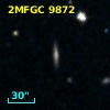 2MFGC 9872