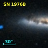 SN 1976B