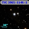 TYC 3965-1148-1
