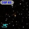 31P 65