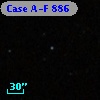 Case A-F  886