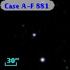 Case A-F  881