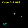 Case A-F  962
