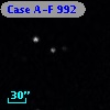 Case A-F  992
