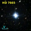 HD   7665