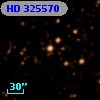 HD 325570