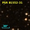 PSR B1552-31