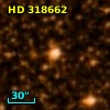 HD 318662