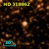 HD 318862