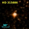 HD 315886