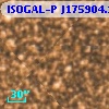 ISOGAL-P J175904.1-291035
