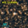 HD 318986