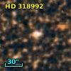 HD 318992