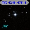 TYC 4241-476-1