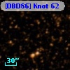 [DBD86] Knot 62