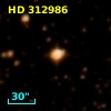 HD 312986