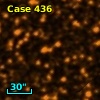 IRAS 17445-1647