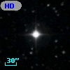 HD 158182