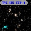 TYC  435-559-1