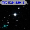 TYC  520-990-1
